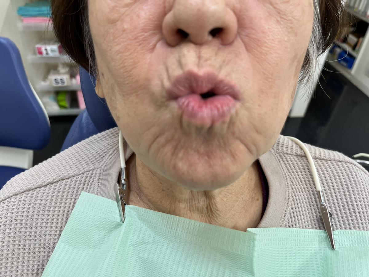 ウー