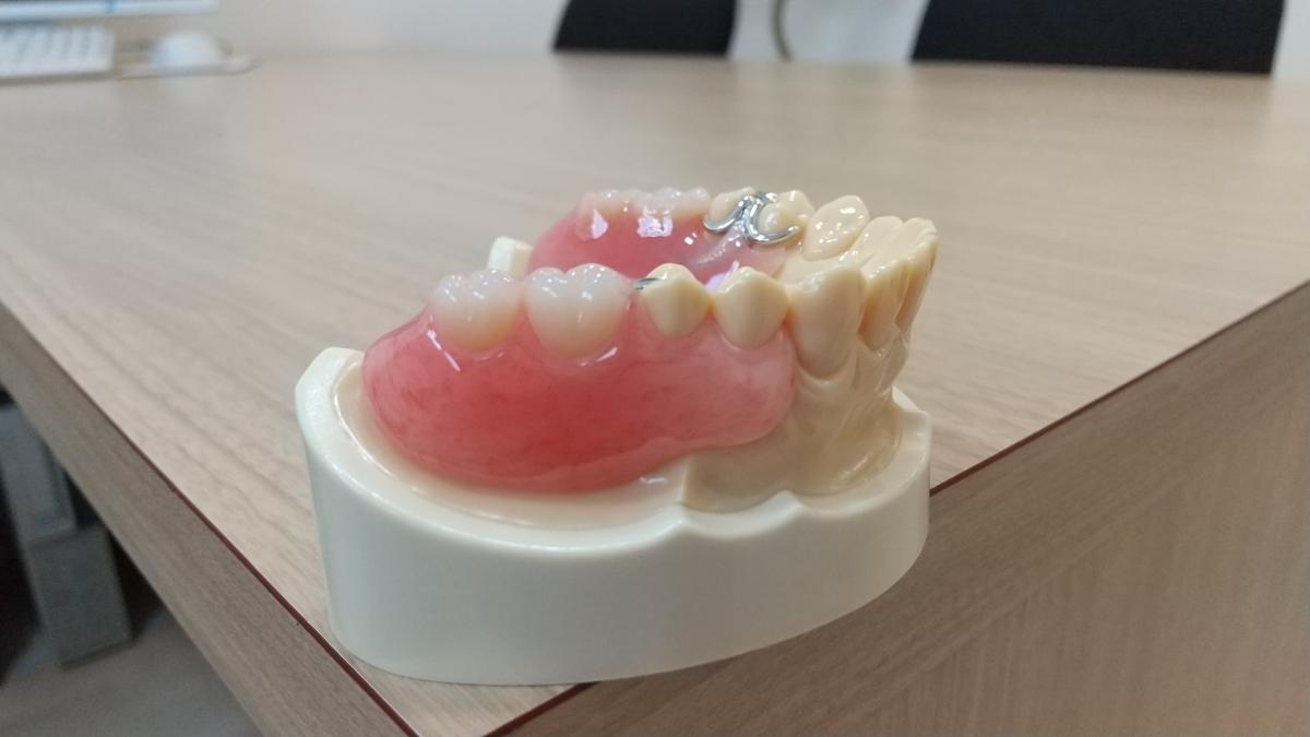 ノンクラスプ