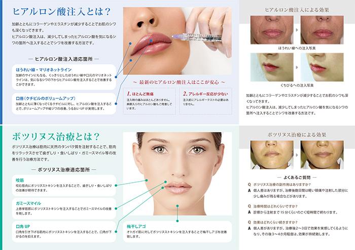 ヒアルロン酸