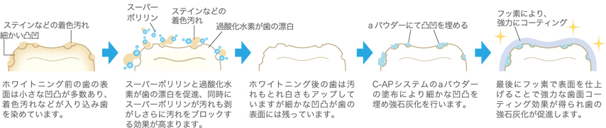 ハイブリットポリリンシステム